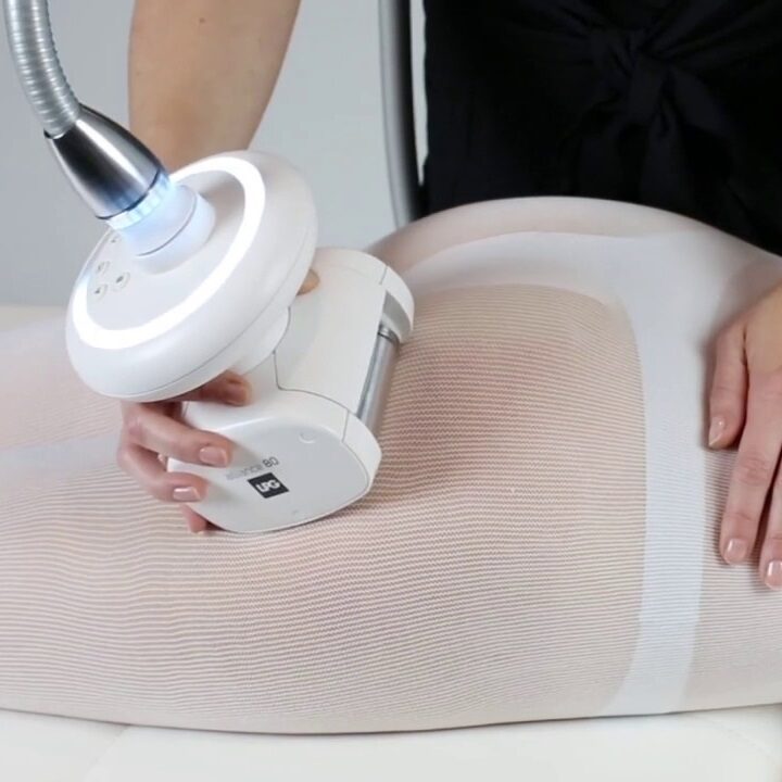 lpg-endermology-body-contouring-at-springs-clinic-in-warrington